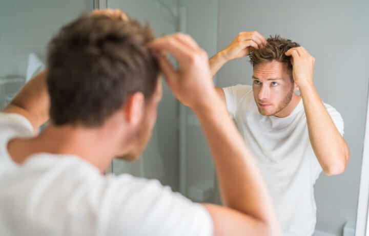 Jovem de 20 anos preocupado com calvície precoce
